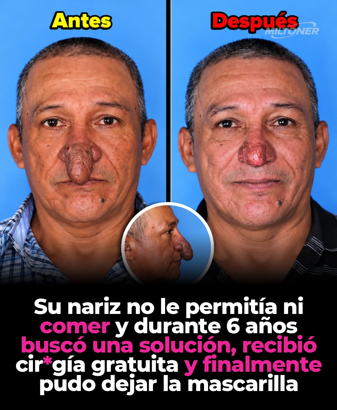 El caso de Conrado Ramos Estrada: la cirugía gratis que le cambió la vida en Nueva York
