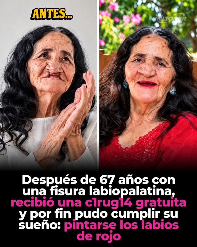 La mujer que cumplió a los 67 su sueño de usar labial rojo tras una cirugía