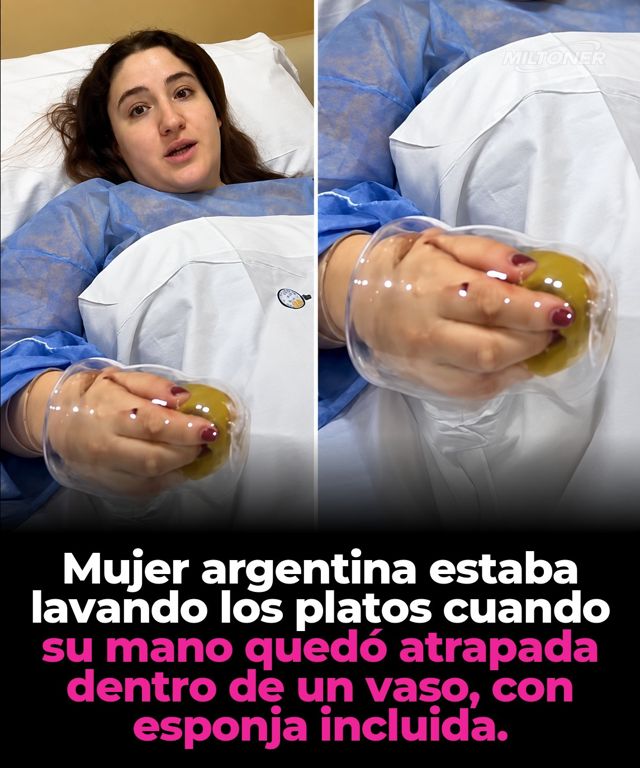 La mano se le quedó atrapada en un vaso y terminó en quirófano